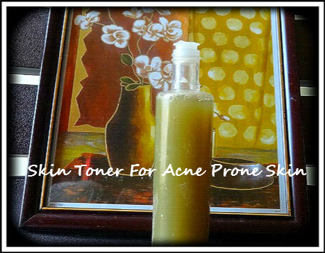 toner for acne prone skin
