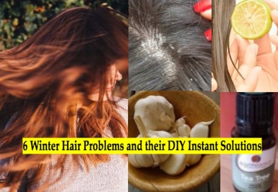 winter hair solutions